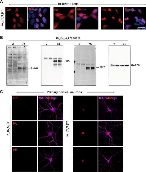 Figures And Data In Antisense But Not Sense Repeat Expanded Rnas