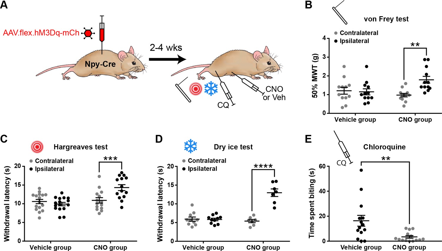 Neuropeptide Y-expressing dorsal horn inhibitory interneurons gate ...