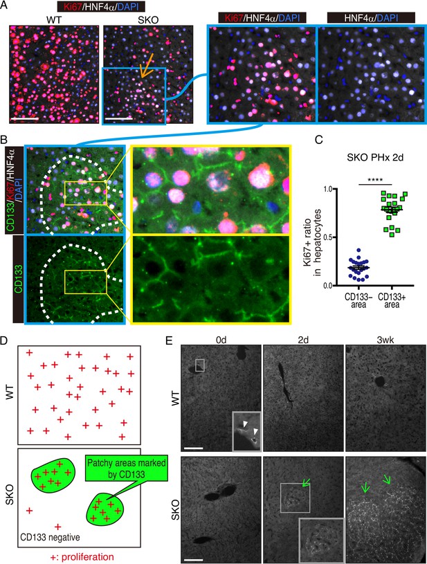 新しいがん治療ターゲットは腫瘍細胞がリソースを共有するのを止める(New Cancer Therapy Target Stops Tumor Cells From Sharing Resources)