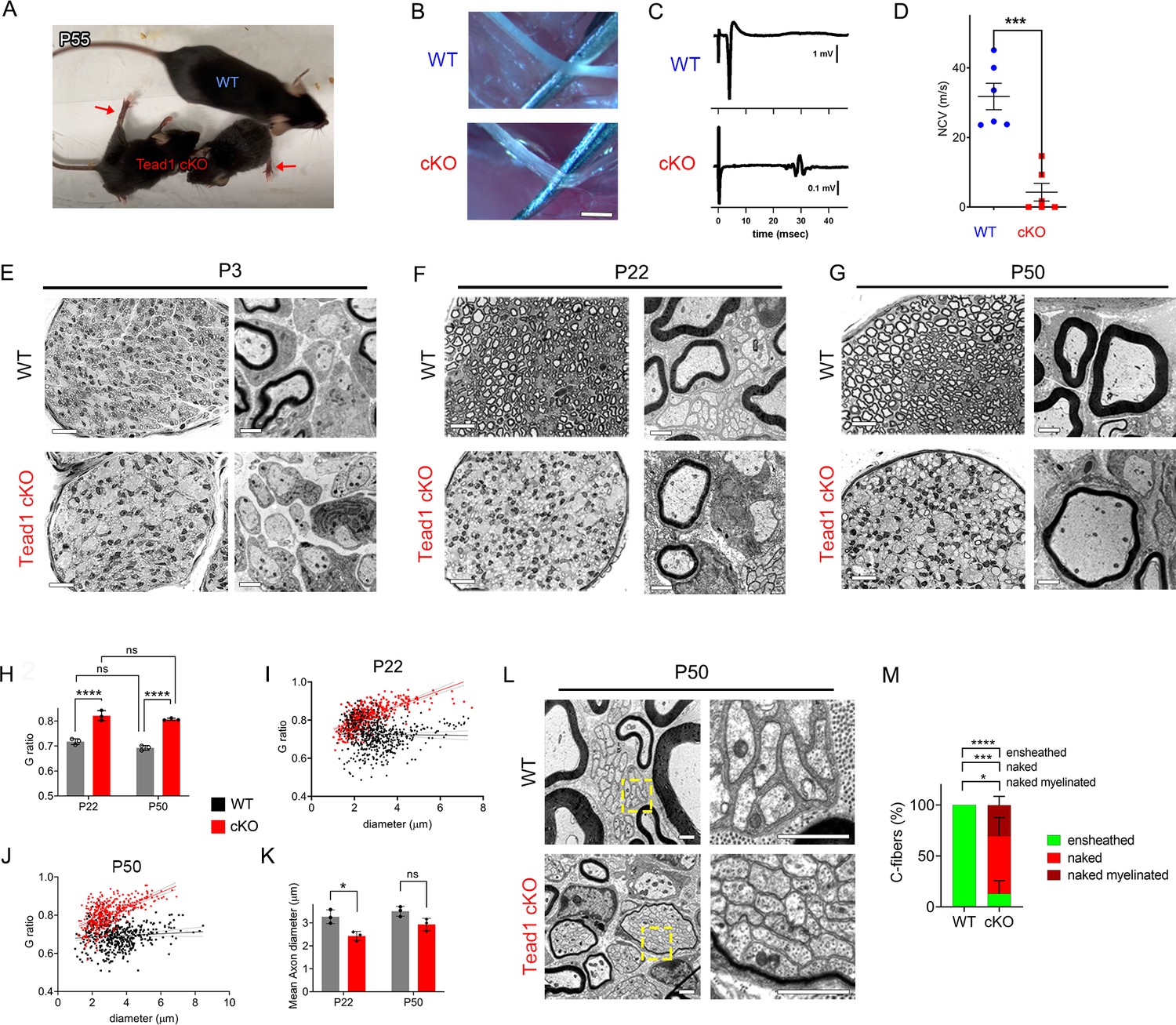 TEAD1 is crucial for developmental myelination, Remak bundles, and ...