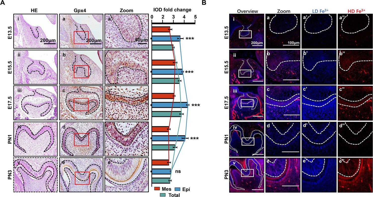 Figures and data in overburdened ferroptotic stress impairs tooth