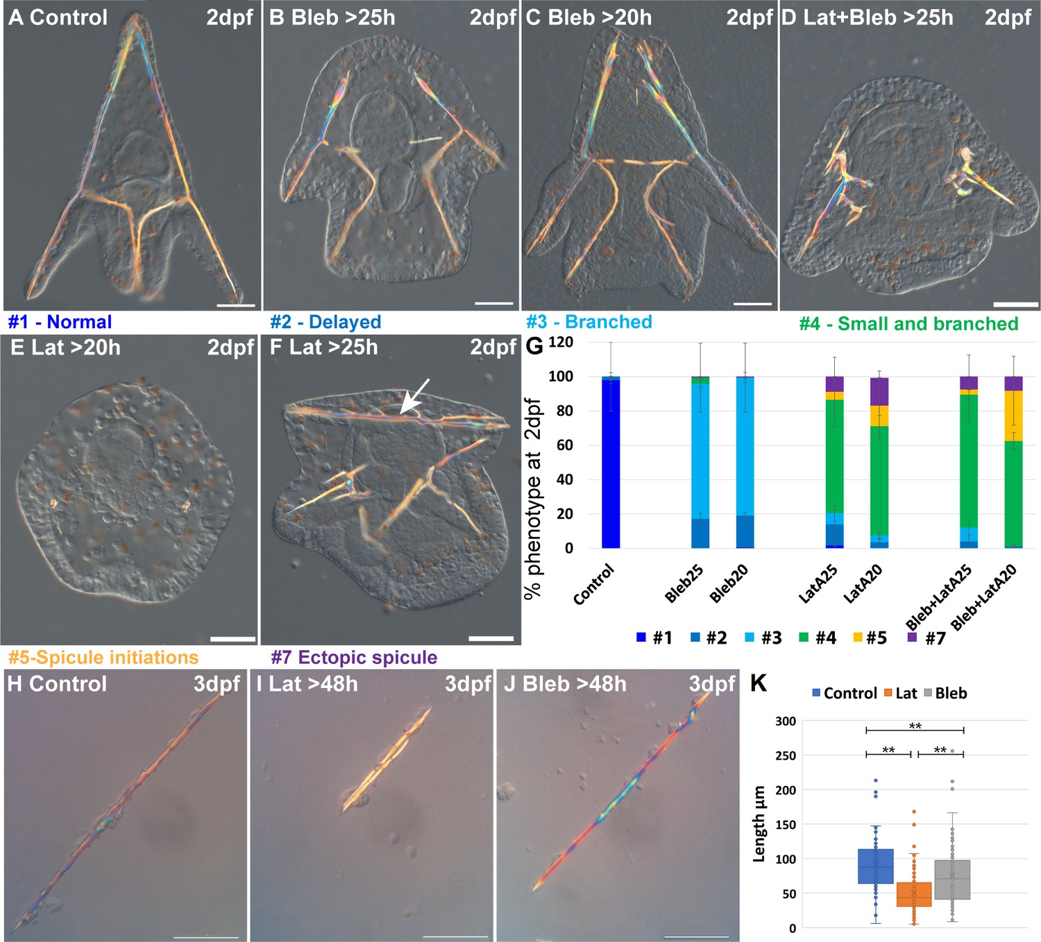 ROCK and the actomyosin network control biomineral growth ROCK and the actomyosin network control biomineral growth