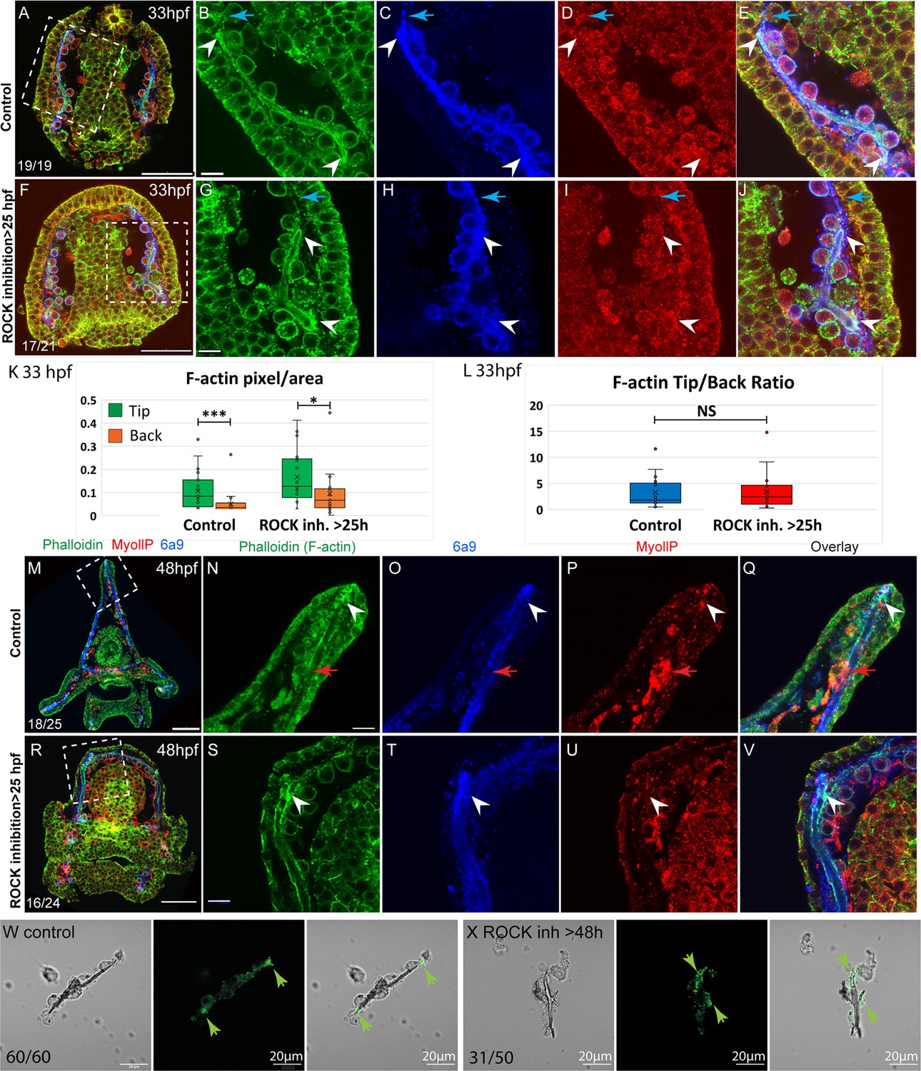 ROCK and the actomyosin network control biomineral growth ROCK and the actomyosin network control biomineral growth