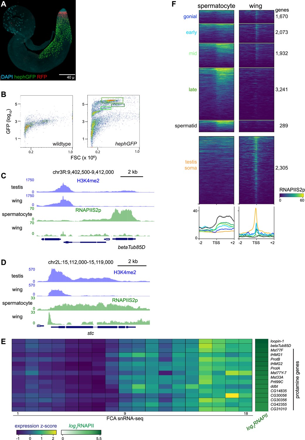 UBR2 mediates transcriptional silencing during spermatogenesis via histone  ubiquitination