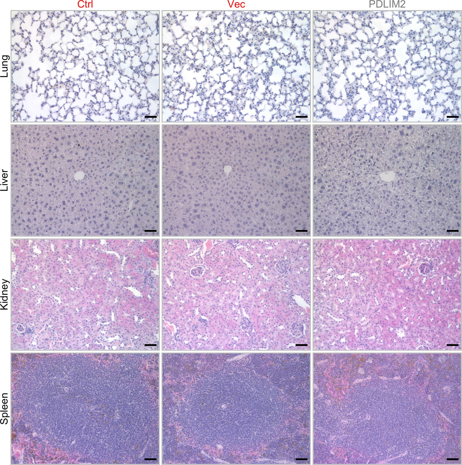 Figures and data in improving pd 1 blockade plus chemotherapy for
