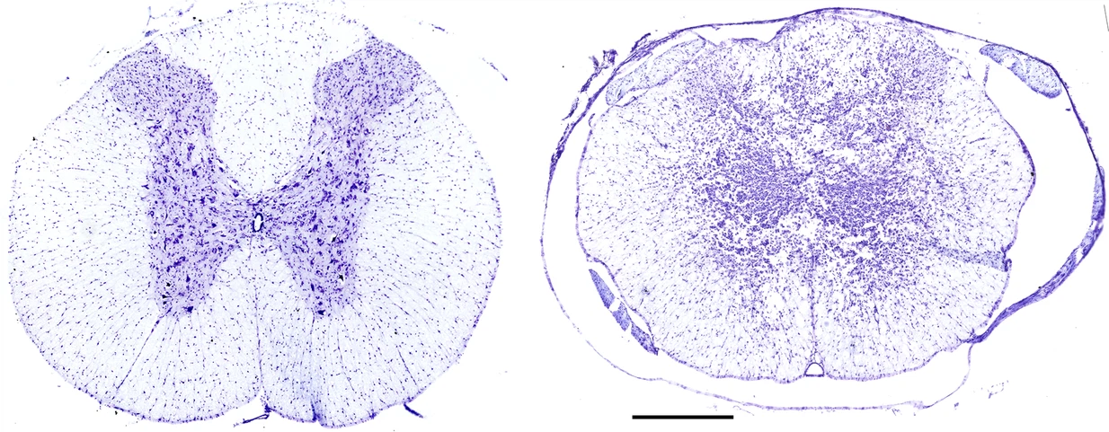 Acute ampakines increase voiding function and coordination in a rat model of SCI