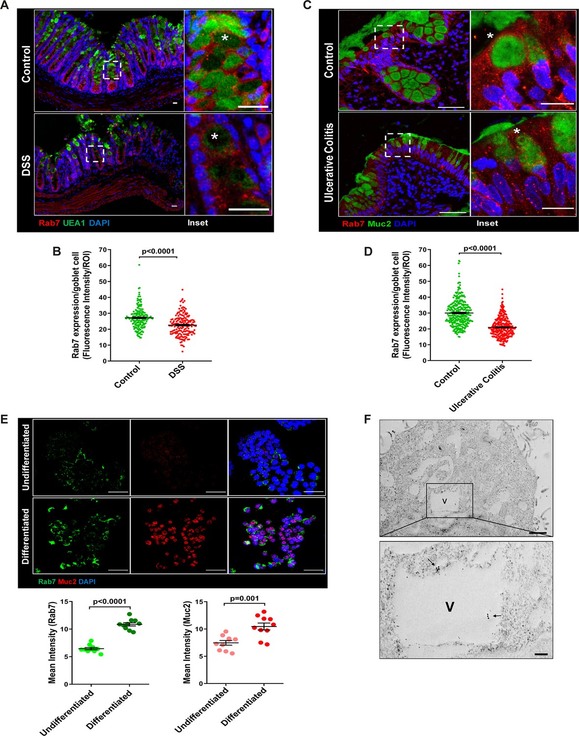 Rab7-dependent regulation of goblet cell protein CLCA1 modulates ...