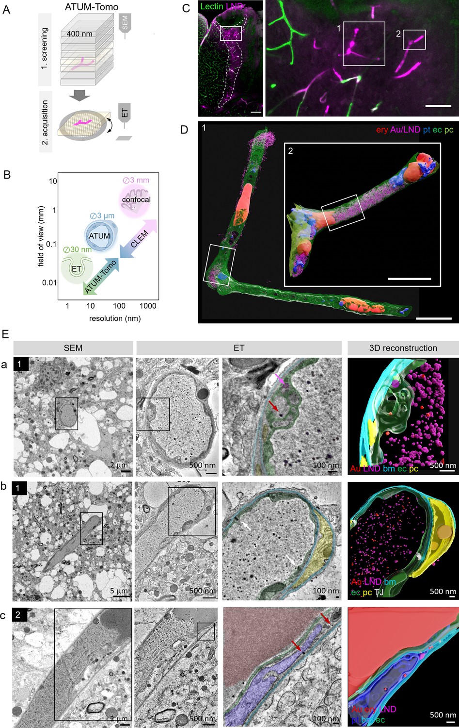 Combining array tomography with electron tomography provides Combining array tomography with electron tomography provides