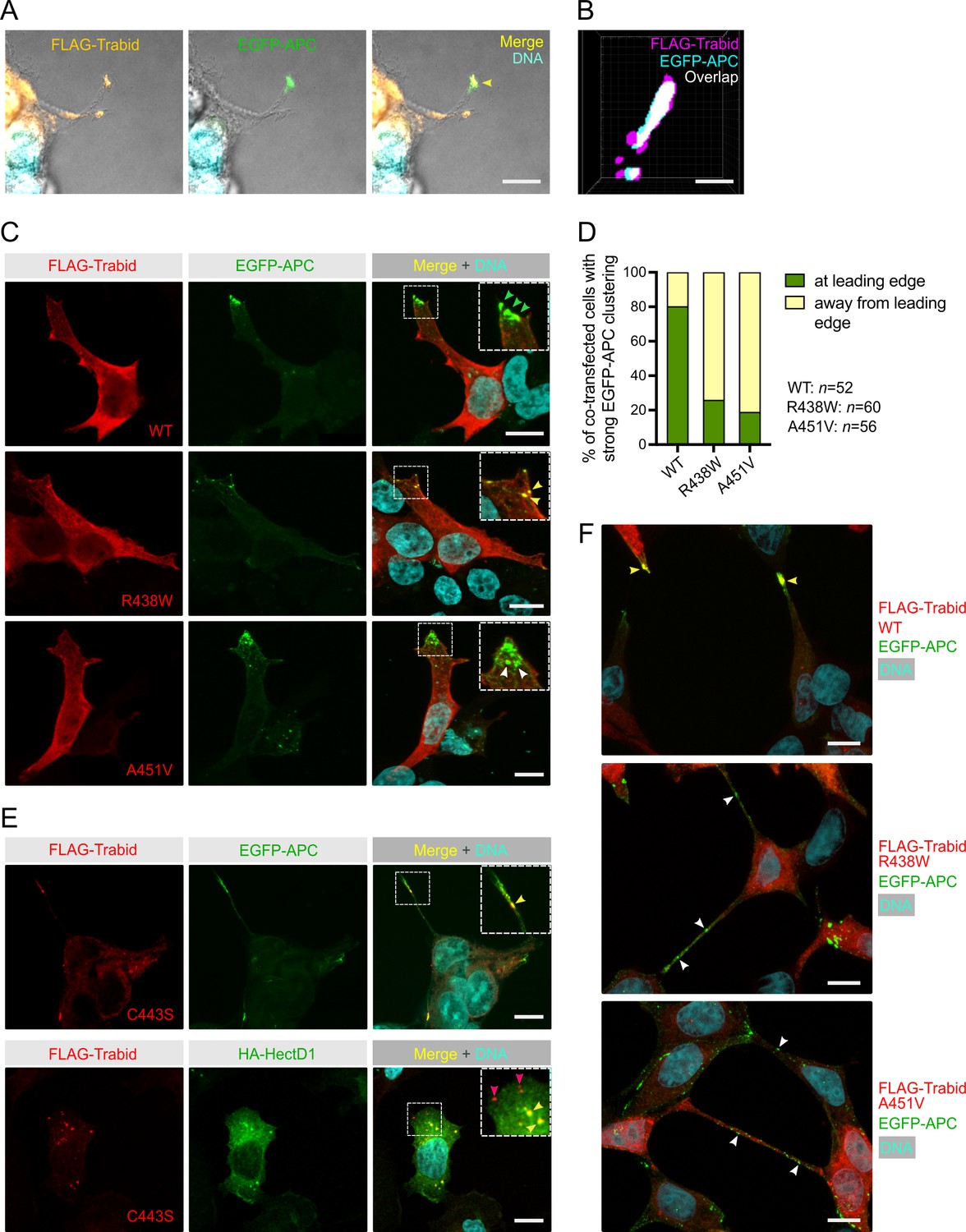 Trabid patient mutations impede the axonal trafficking of 