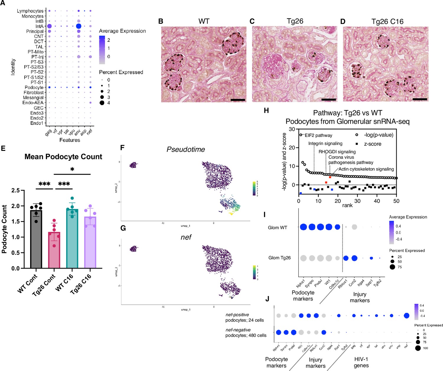 PKR activation-induced mitochondrial dysfunction in HIV-transgenic mice ...