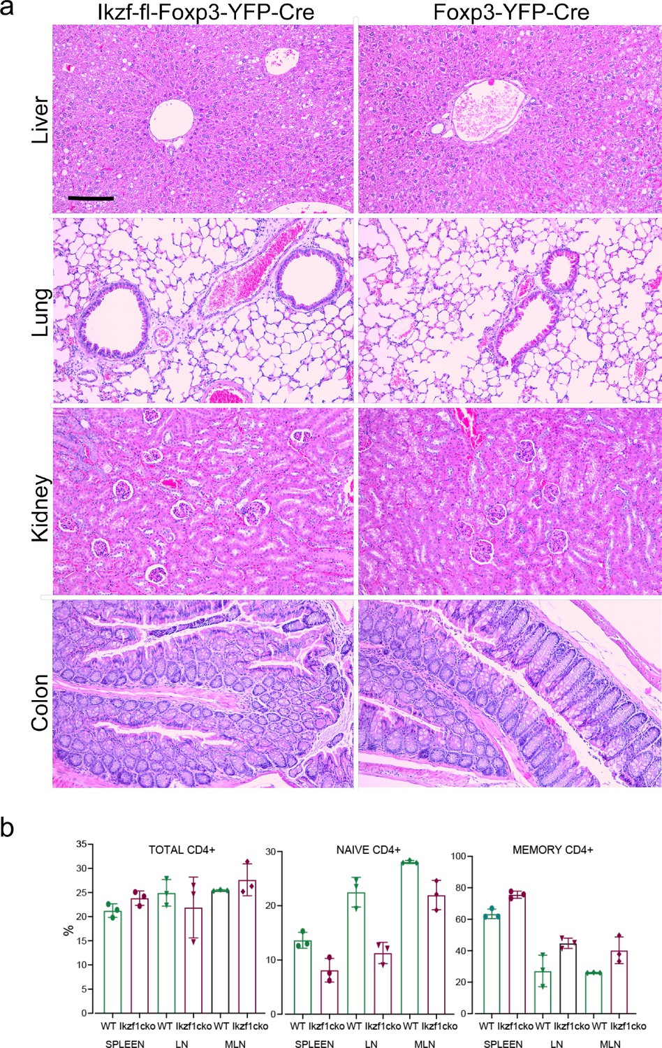 Figures and data in Foxp3 depends on Ikaros for control of regulatory T ...