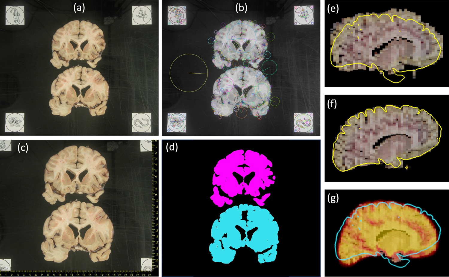 Figures and data in Machine learning of dissection photographs and ...