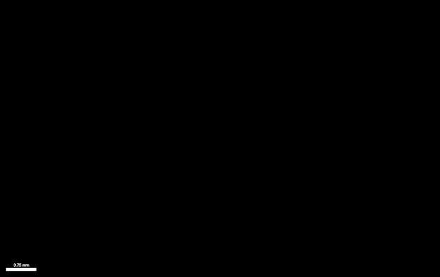 posterframe for video