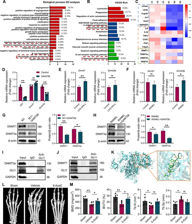 GLI1 facilitates collagen-induced arthritis in mice by collaborative ...