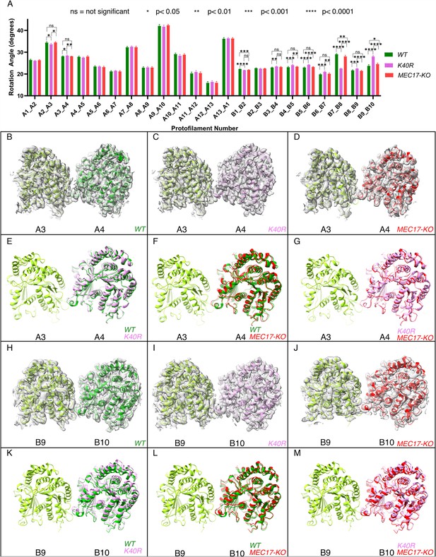 Effect Of Tubulin Acetylation On The Doublet Microtubule Structure