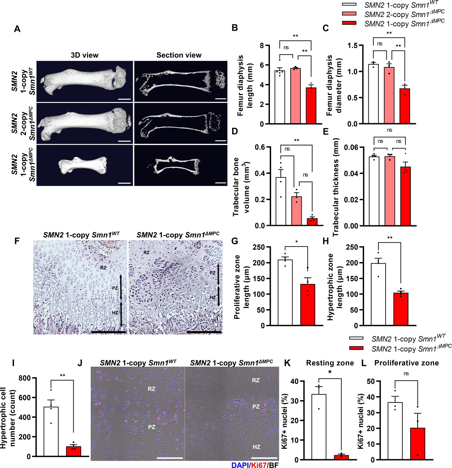 Depletion of SMN protein in mesenchymal progenitors impairs the ...