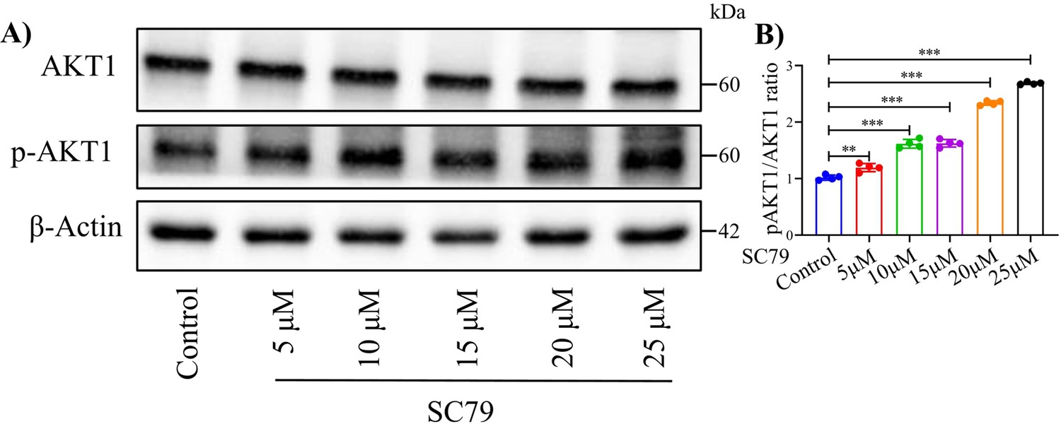 Aberrant methylation and expression of TNXB promote