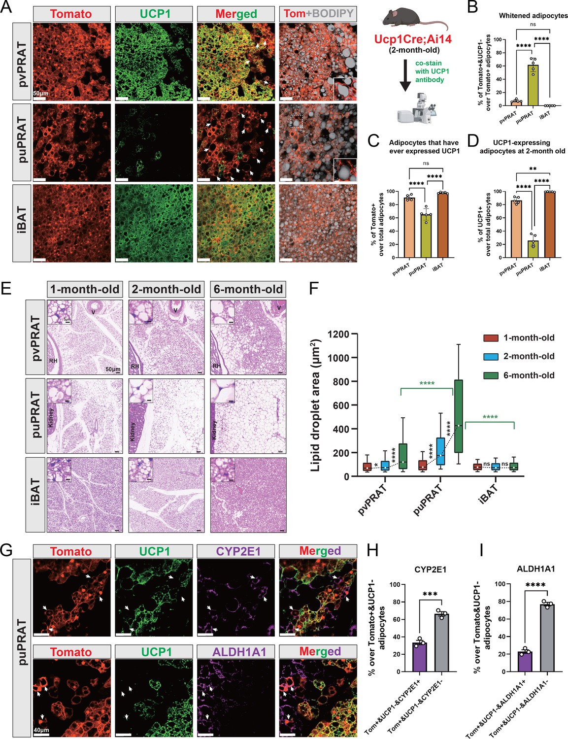 Perirenal Adipose Tissue Contains A Subpopulation Of Cold Inducible