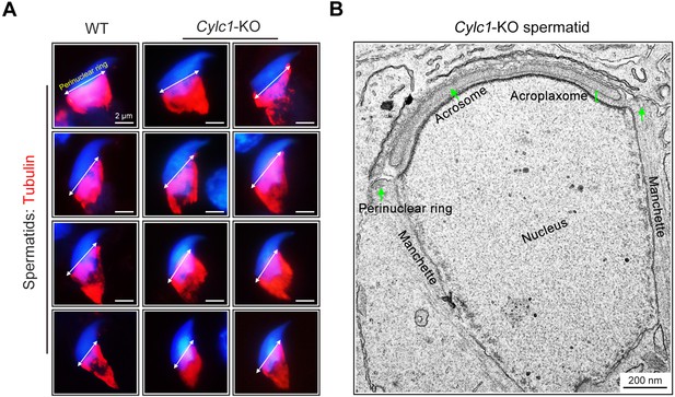 Figures And Data In Disruption In CYLC1 Leads To Acrosome Detachment ...