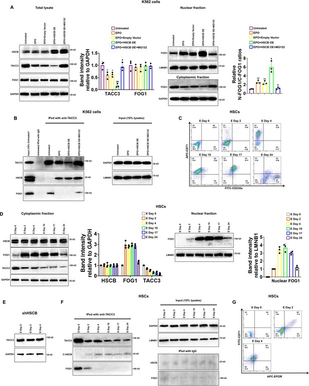 PI3K/HSCB axis facilitates FOG1 nuclear translocation to promote ...