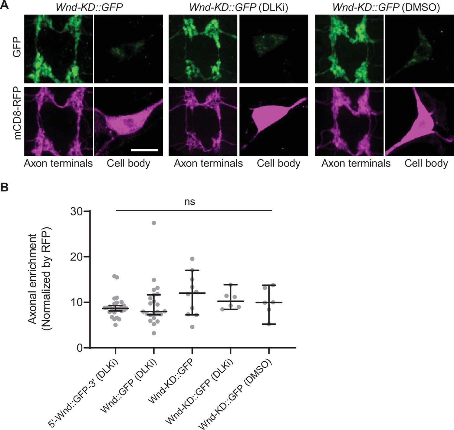 Rab11 suppresses neuronal stress signaling by localizing