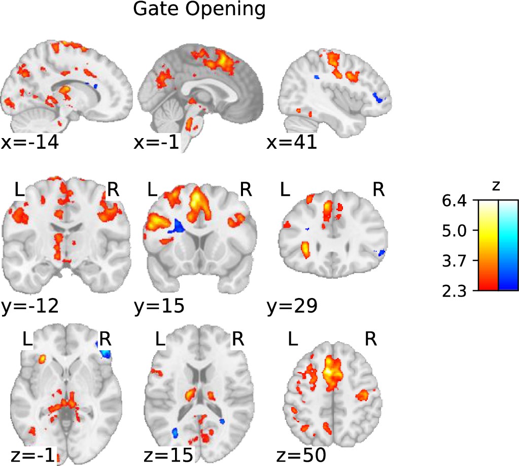 脳機能入門 = A Glimpse of Brain Functions : … 脳機能 入門: 機能局在から症状・リハビリまで／実際の症状が