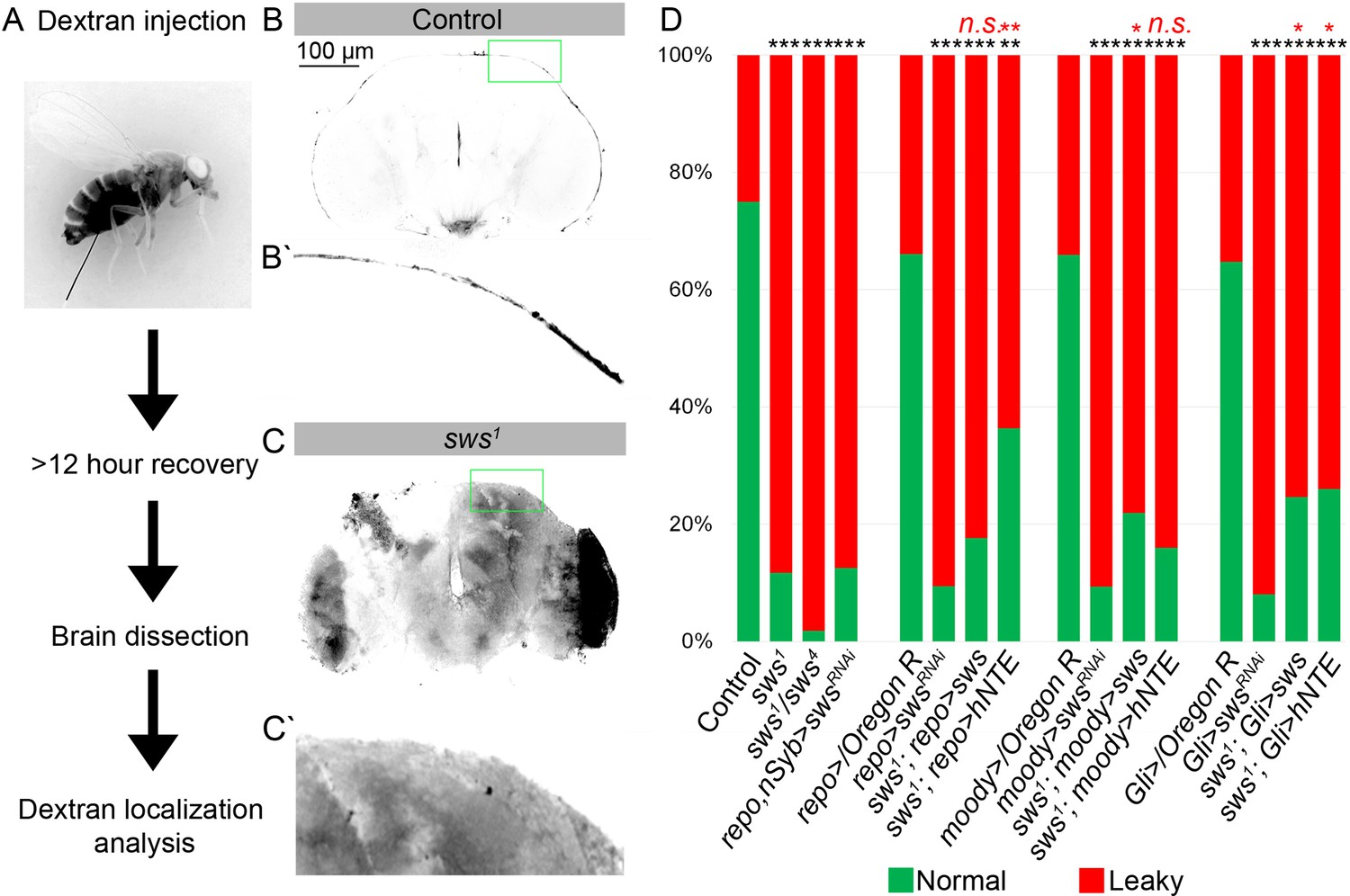 Unraveling The Link Between Neuropathy Target Esterase NTE SWS